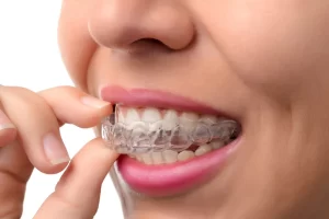 Mouth Guard From Your Dentist